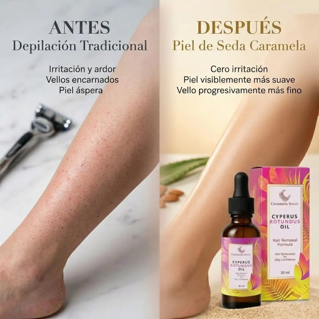 Comparación antes y después: eliminación de piel de fresa, vellos encarnados e irritación usando el aceite Caramela Cyperus.